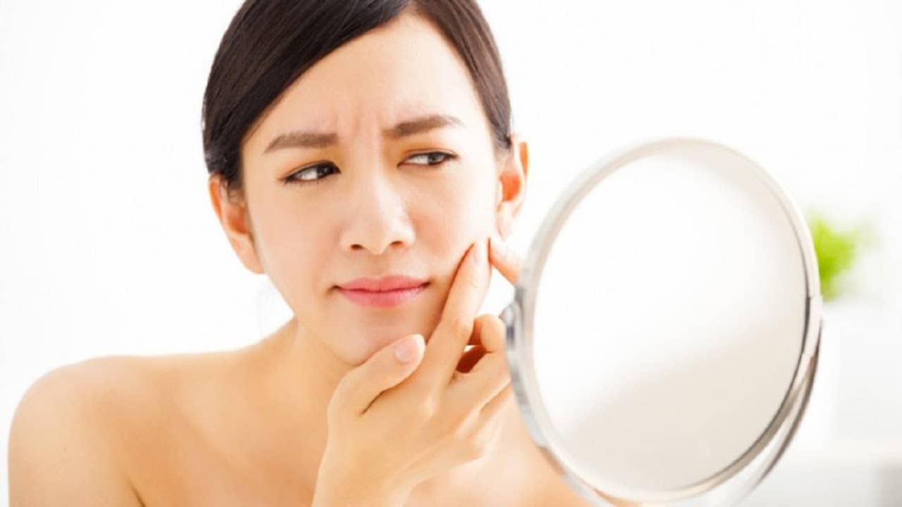 Mụn nội tiết là gì